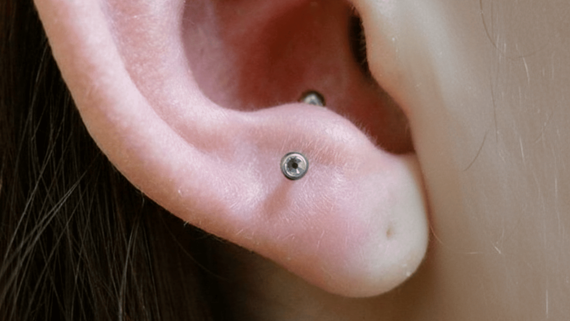 Anti-Tragus