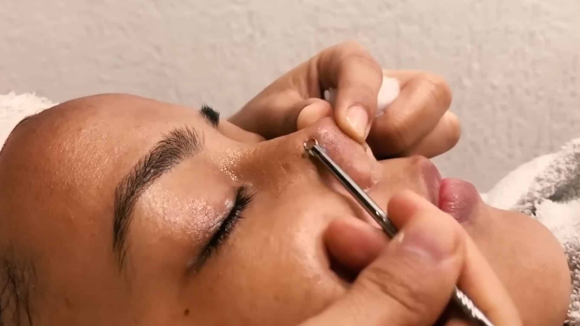 Gently remove blackheads and whiteheads, then apply toner to close pores and balance skin’s pH after extractions. (1)