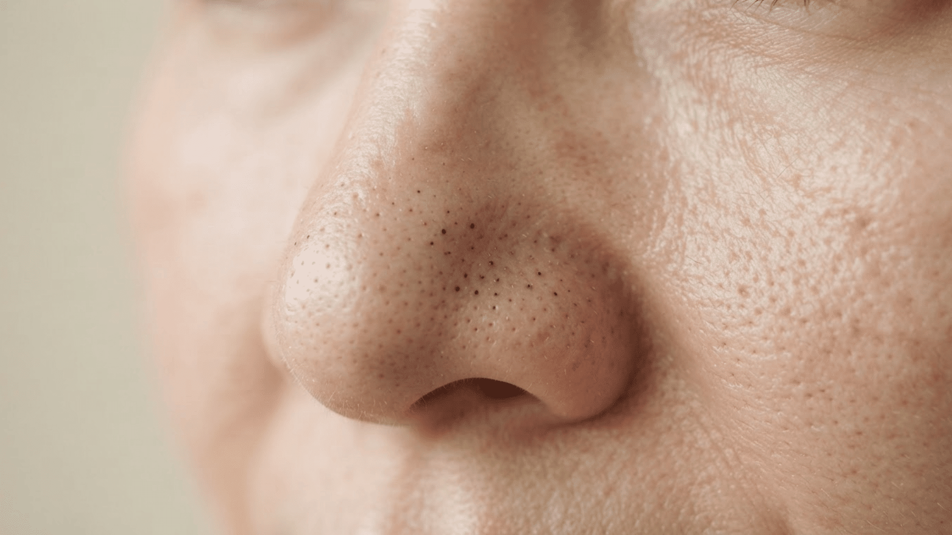 close-up view of blackheads appearing as small dark dots on nose pores and surrounding skin