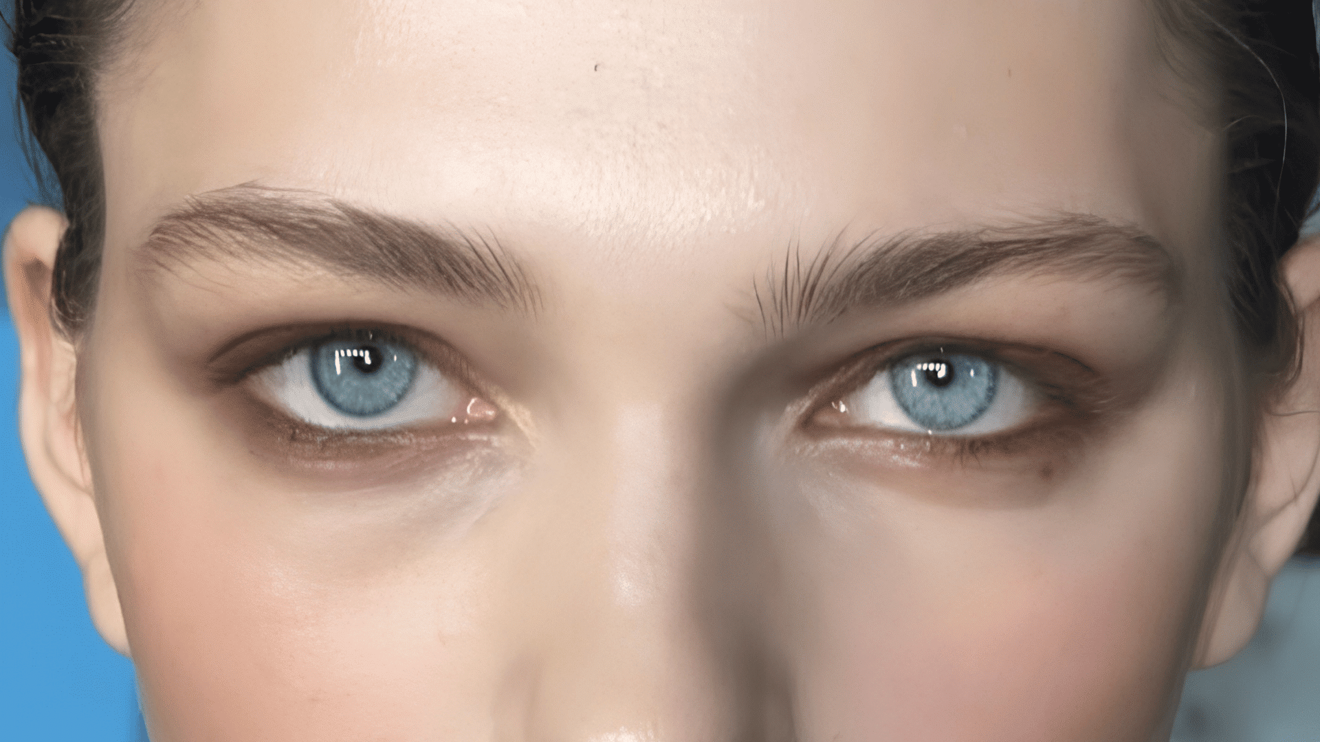 close view of hooded eyelids showing extra skin covering the natural eyelid crease area