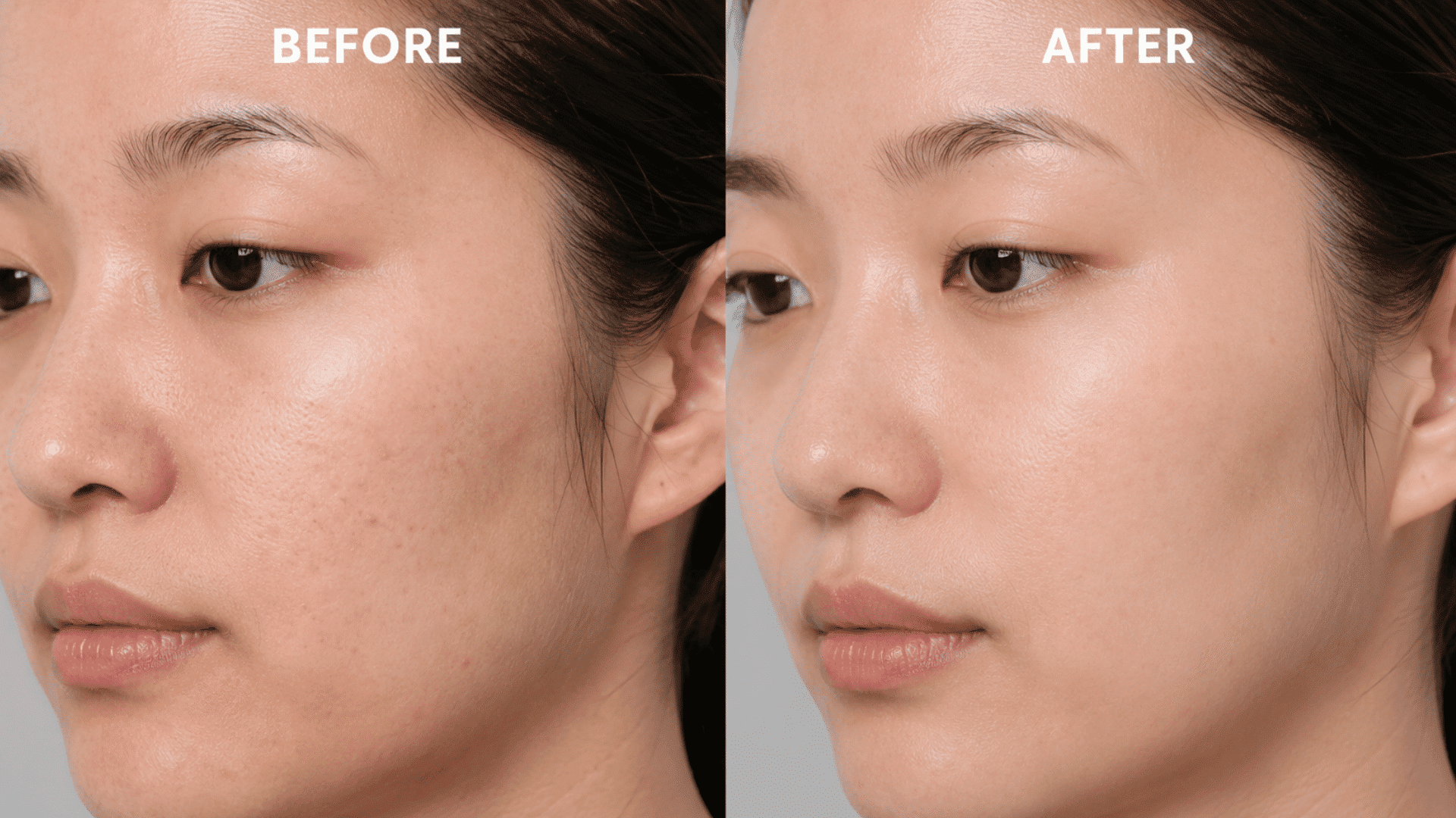 snail-mucin-before-and-after-results