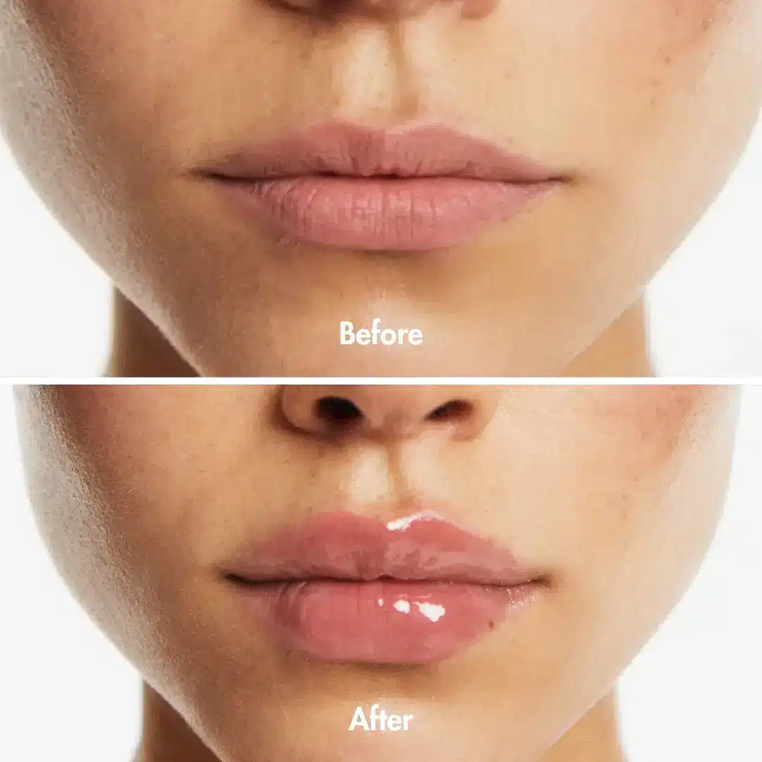 Close-up of lips with matte finish and glossy finish, showing before and after effect